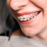 Understanding Bite Problems And How Braces Can Help