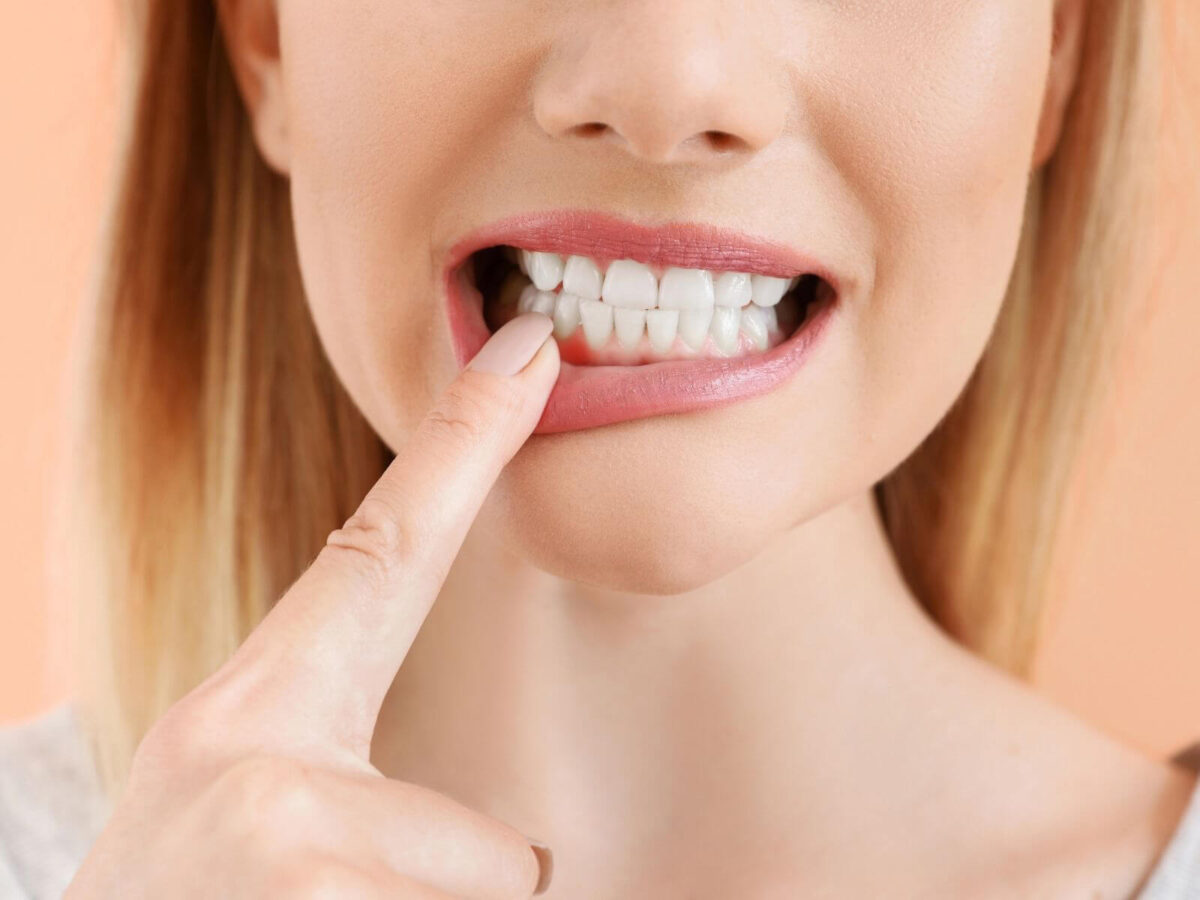 Signs You Might Have Gum Disease And How To Prevent It