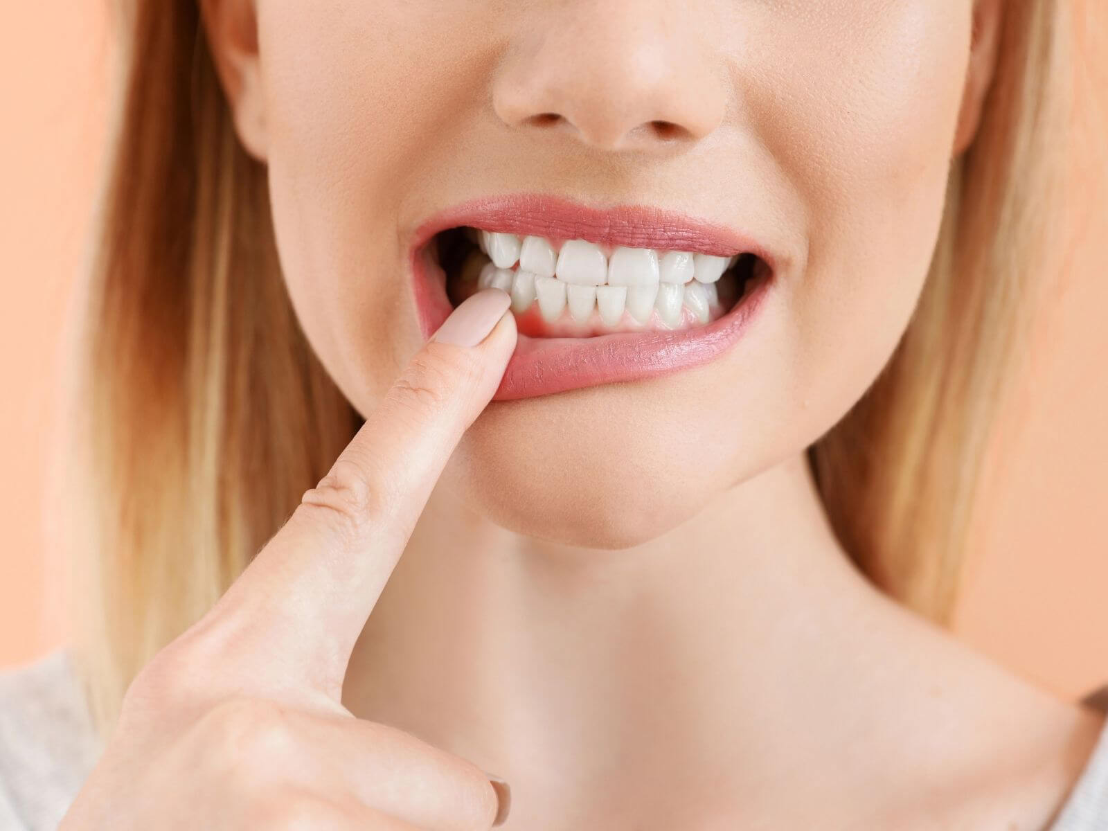 Signs You Might Have Gum Disease And How To Prevent It