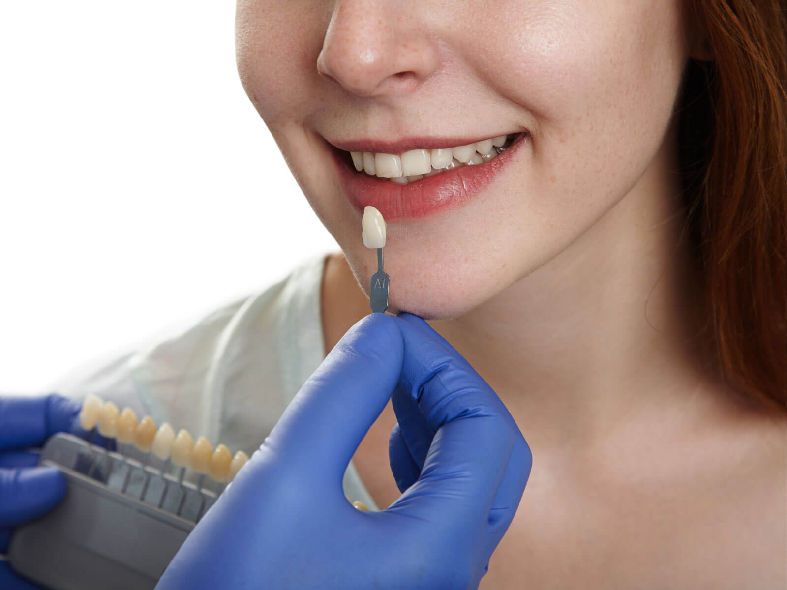 What Is a Dental Crown? Benefits, Uses, and Procedure