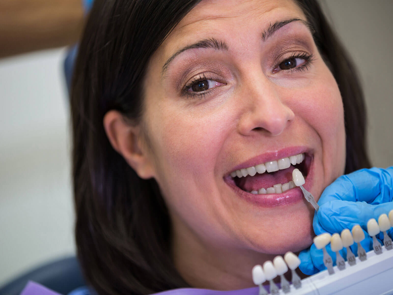 How Much Do Dental Veneers Cost? Porcelain vs Composite, Per Tooth & Full Smile Pricing